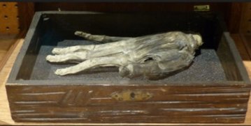 The Hand by Guy de Maupassant